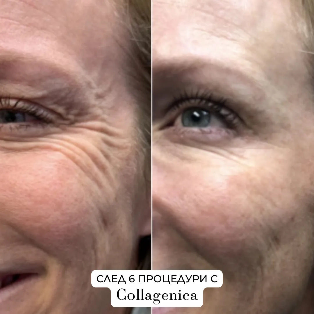 Collagenica – Анти-Ейдж микронидлинг система за дълбоко подхранване и регенериране на кожата